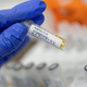 Image for article titled What to Know About Johnson & Johnson's One-Shot Covid-19 Vaccine